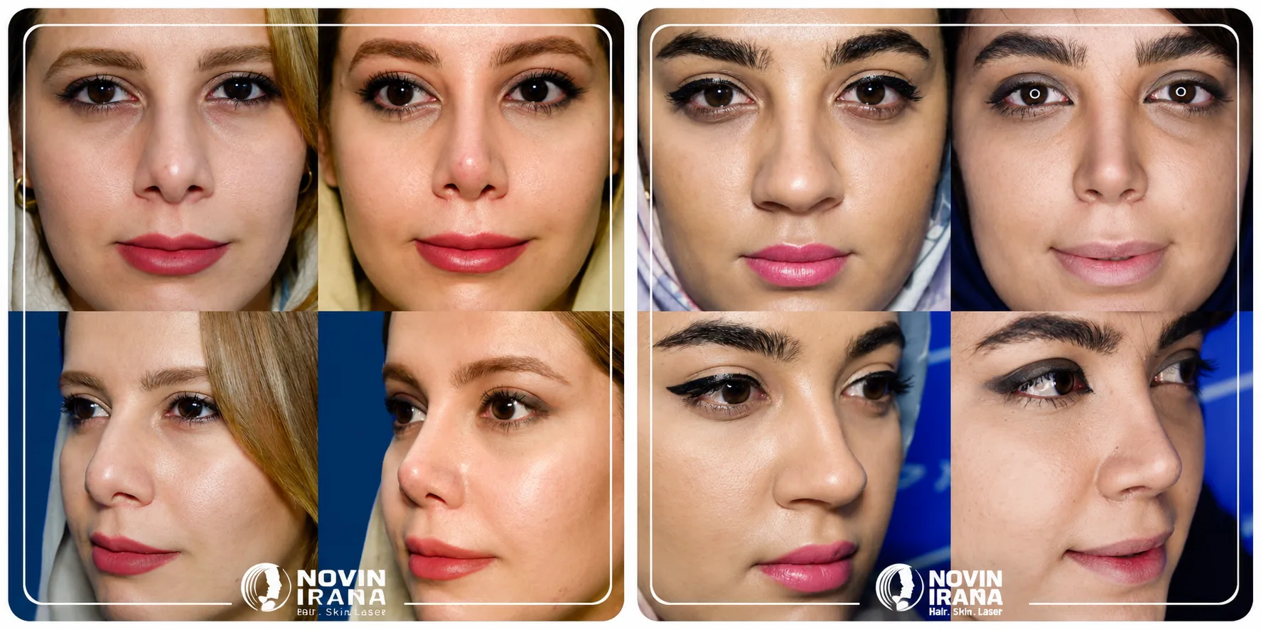 أفضل دكتور تجميل الأنف نوين إيرانا في إيران مشهد